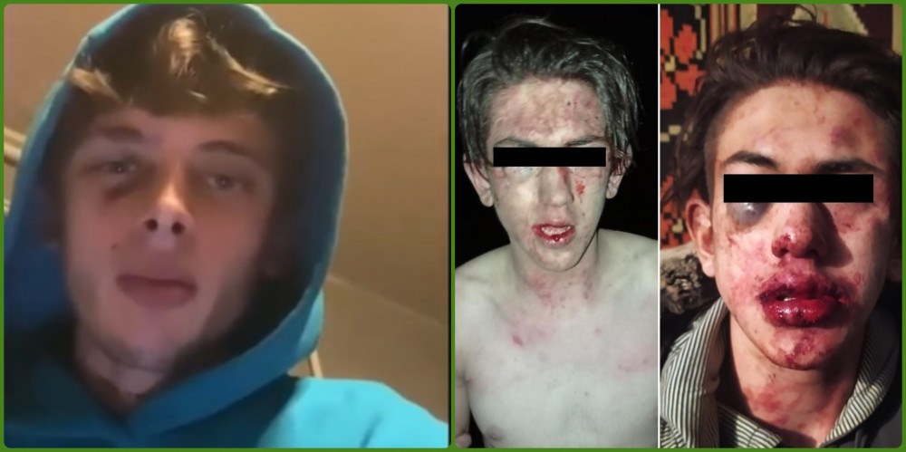 „Adevărul” despre bătaia de la Glodeni. Versiunea tânărului de 18 ani care a bătut un minor de 15 ani
